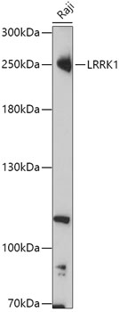 Anti-LRRK1 Antibody (CAB17768)