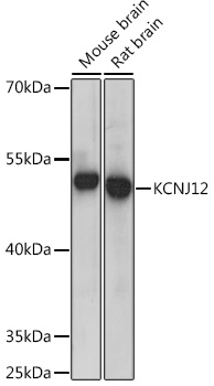 Anti-KCNJ12 Antibody (CAB14375)