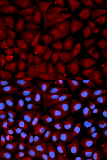 Anti-SERPINC1 Antibody (CAB1574)