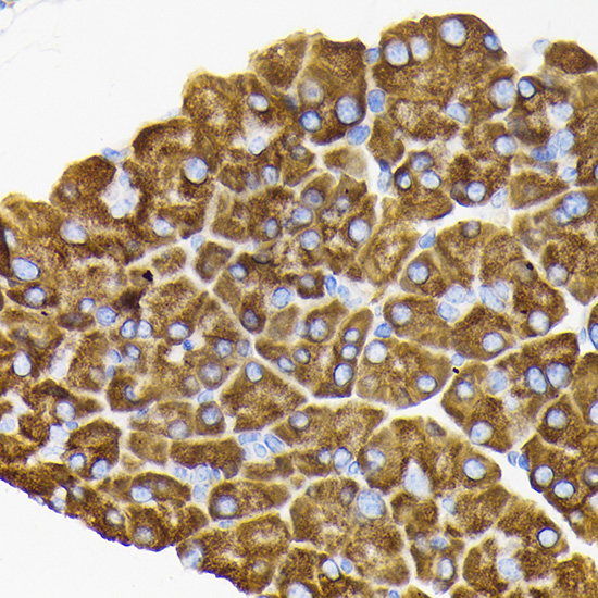 Anti-RPS3 Antibody (CAB2533)