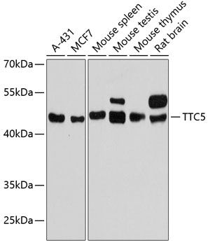 Anti-TTC5 Antibody (CAB13232)