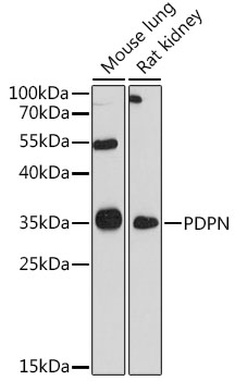 Anti-PDPN Antibody (CAB13261)