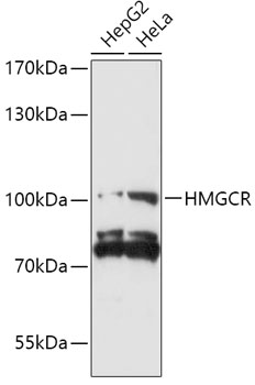 Anti-HMGCR Antibody [KO Validated] (CAB14741)