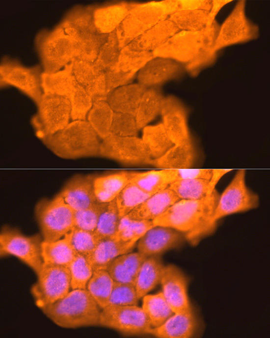 Immunofluorescence analysis of A431 cells using LORICRIN Rabbit pAb at dilution of 1:200 (40x lens). Blue: DAPI for nuclear staining.