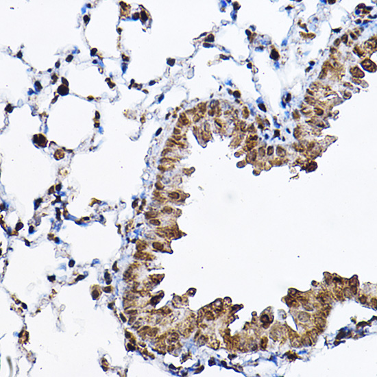 Anti-p70 S6 kinase Antibody (CAB16658)