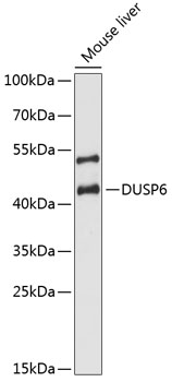 Anti-DUSP6 Antibody (CAB3171)