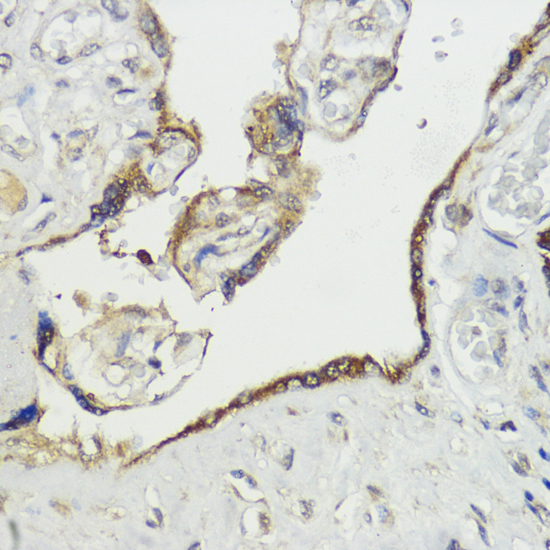 Anti-HACE1 Polyclonal Antibody (CAB9593)