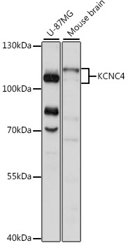 Anti-KCNC4 Antibody (CAB15682)