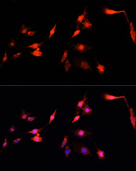 Anti-NRF1 Antibody (CAB14190)