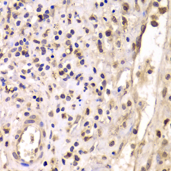 Anti-HDAC4 Antibody (CAB7951)