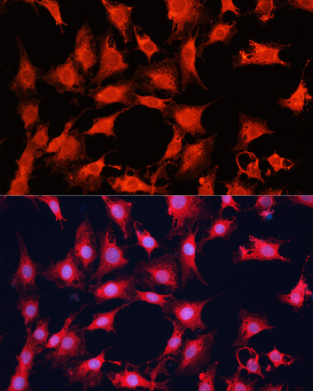 Anti-mTOR Antibody (CAB2445)