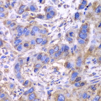 Anti-SDHA Antibody (CAB2594)