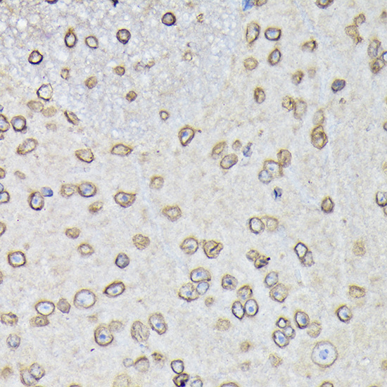 Anti-Lamin B1 Antibody (CAB16909)