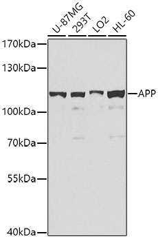 Anti-APP Antibody (CAB0206)