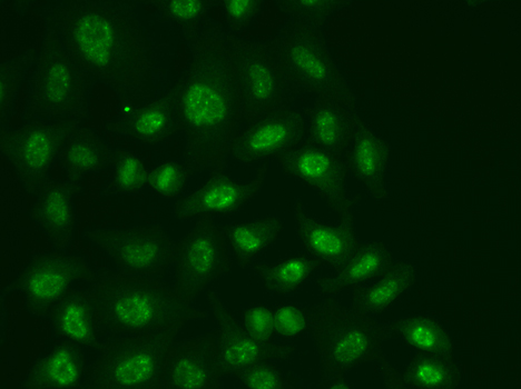 Anti-POLR2E Antibody (CAB1755)