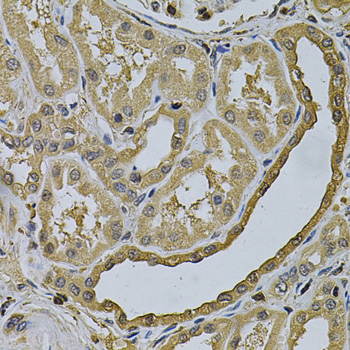 Anti-LCP1 Antibody (CAB13504)