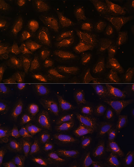 Anti-CKMT1B Antibody (CAB3046)