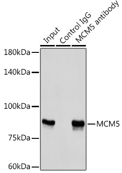 Anti-MCM5 Antibody (CAB5556)