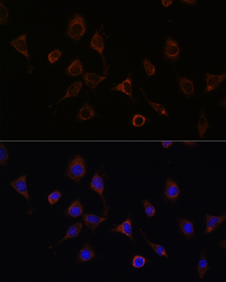 Anti-NFS1 Antibody (CAB6668)