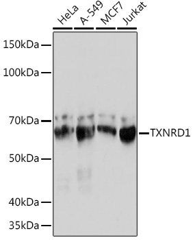 Anti-TXNRD1 Antibody (CAB4725)