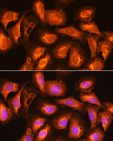 Anti-SEC11A Antibody (CAB10552)