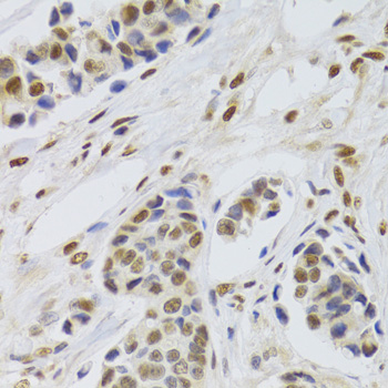 Anti-PPP1R8 Antibody (CAB6701)