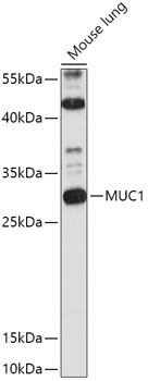 Anti-MUC1 Antibody (CAB0333)