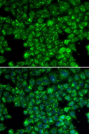 Anti-LYZL6 Antibody (CAB1067)