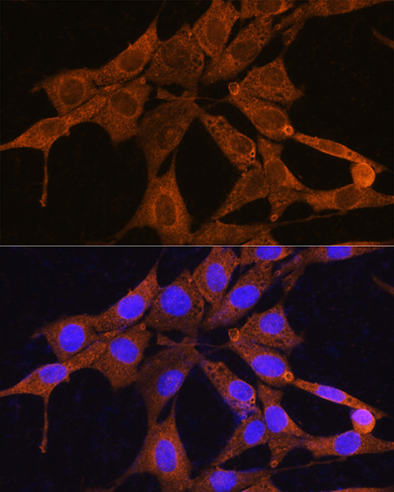 Anti-NMNAT3 Antibody (CAB14465)