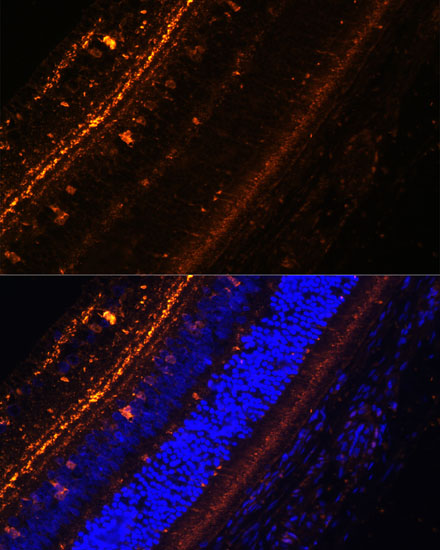 Anti-KCNS2 Antibody (CAB15684)