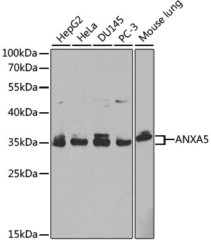 Anti-ANXA5 Antibody [KO Validated] (CAB1728)