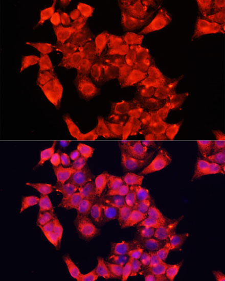 Anti-AOC1 Antibody (CAB6249)