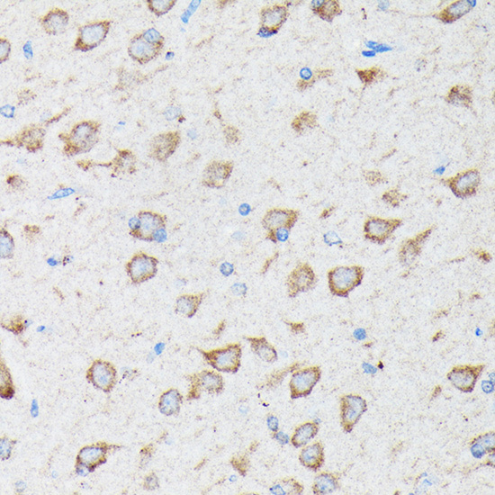 Anti-CYLD Antibody (CAB3821)