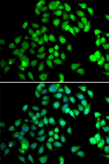 Anti-NCBP2 Antibody (CAB7293)