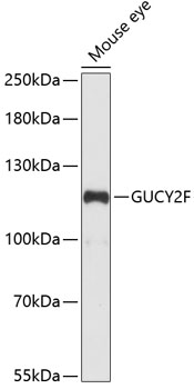 Anti-GUCY2F Antibody (CAB14242)