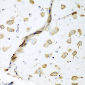 Anti-ELAVL2 Antibody (CAB5918)