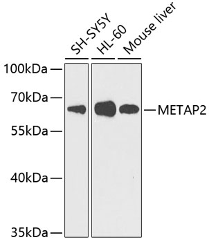 Anti-METAP2 Antibody (CAB5962)