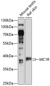 Anti-MC1R Antibody (CAB13512)