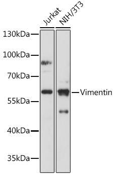 Anti-Vimentin Antibody (CAB2584)