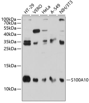 Anti-S100A10 Antibody (CAB14658)