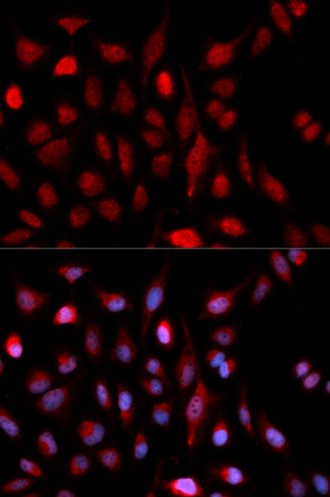 Anti-ASH2L Antibody (CAB5392)