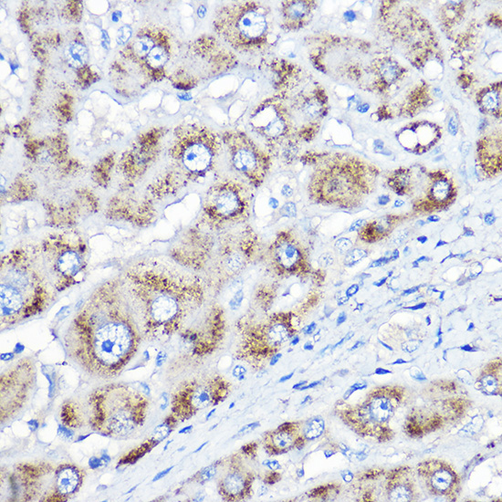 Anti-AGXT Polyclonal Antibody (CAB8397)