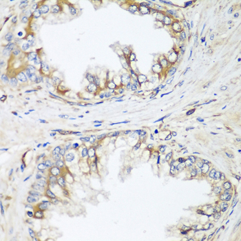 Anti-HPSE2 Polyclonal Antibody (CAB8248)