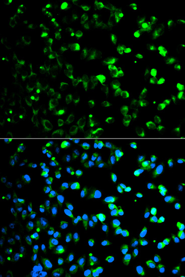 Anti-TYMP Antibody (CAB1094)