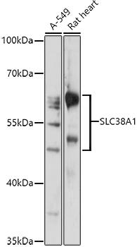 Western blot analysis of extracts of various cell lines, using SLC38A1 antibody at 1:1000 dilution. Secondary antibody: HRP Goat Anti-Rabbit IgG (H+L) at 1:10000 dilution. Lysates/proteins: 25ug per lane. Blocking buffer: 3% nonfat dry milk in TBST. Detection: ECL Enhanced Kit. Exposure time: 60s.