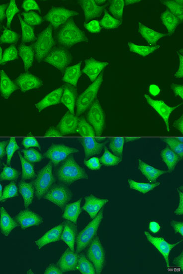 Anti-Eif2ak2 Antibody [KO Validated] (CAB5578)