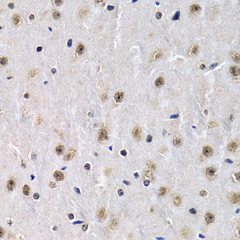 Anti-PTHLH Antibody (CAB1654)