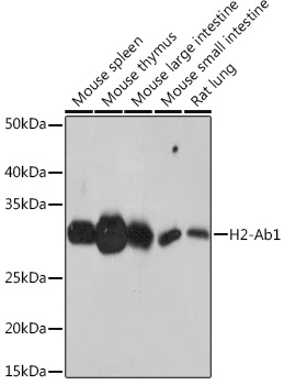 Anti-H2-Ab1 Antibody (CAB18658)