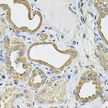 Anti-ICOSL Antibody (CAB7080)