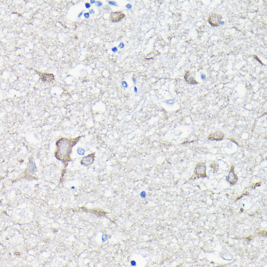 Anti-EEF1A2 Antibody (CAB7327)